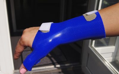 Пластиковий гіпс, заміна гіпсу на пластик