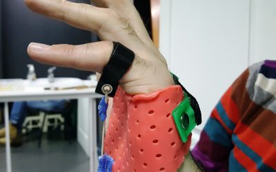 Динамічні ортези