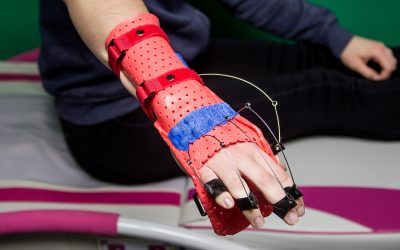 Майстер-клас «Динамічне ортезування кисті та пальців верхньої кінцівки: виготовлення ортезів-тренажерів» 09 лютого 2019 р.