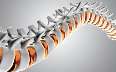 Правда про сколіоз та сучасні спосіби його лікування